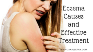 What Exactly Is Eczema and How Can it be Treated Effectively